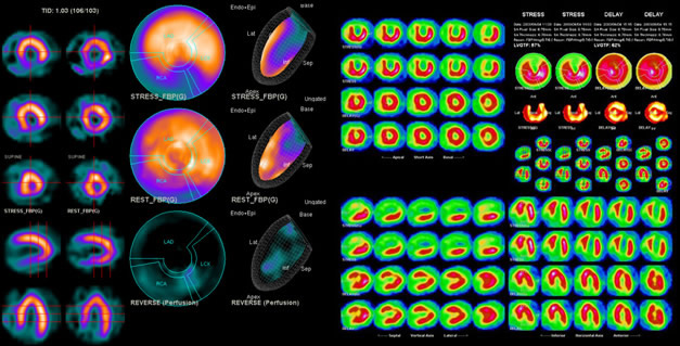 Bone Scan Image